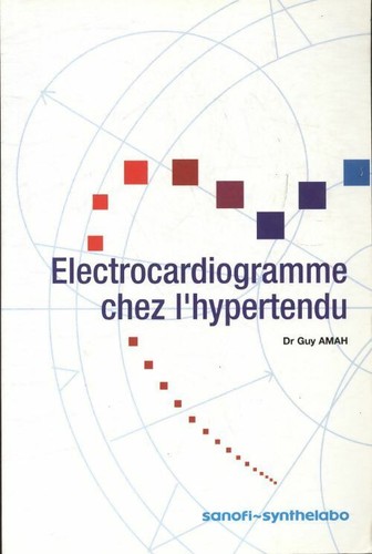 électrocardiogramme chez - Électrocardiogramme,